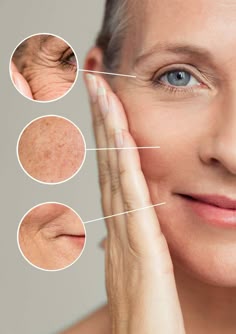SkinGlow™ Botox Serum