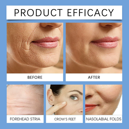 SkinGlow™ Botox Serum